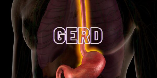 GERD – Choroba refluksowa, co&nbsp;musisz wiedzieć